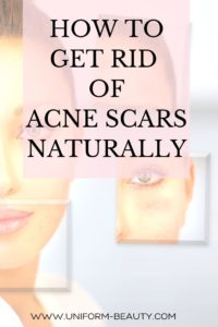 Acne Treatment
