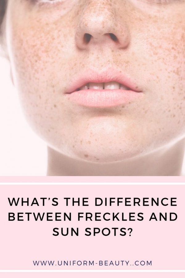 freckles girl